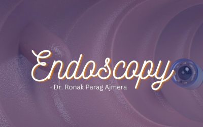 Endoscopy is a pain-free procedure. So don’t worry if you have got prescribed by our doctor.