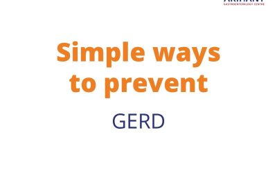 Simple ways to prevent GERD